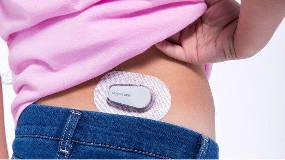 Bērns ar Dexcom ONE uz sēžamvietas augšdaļas